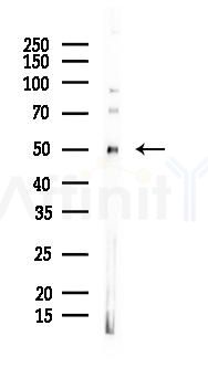 EF-Tu Mouse Monoclonal Antibody - Western blot analysis of lysates from K562 cells(heat-shock 45min treatment), using EF-Tu Mouse Monoclonal Antibody at 1/1000 dilution.