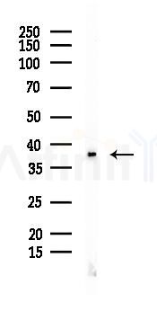 FGFP1 Mouse Monoclonal Antibody - Western blot analysis of lysates from PC12 cells(LPS 4h treatment), using FGFP1 Mouse Monoclonal Antibody at 1/1000 dilution.