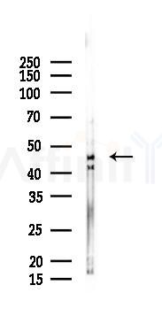 SERPINA11 Mouse Monoclonal Antibody - Western blot analysis of lysates from A2780 cells(LPS 4h treatment), using SERPINA11 Mouse Monoclonal Antibody at 1/1000 dilution.