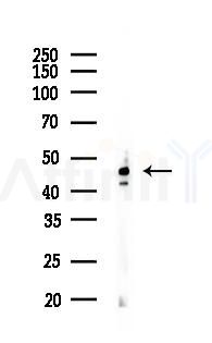 SERPINA11 Mouse Monoclonal Antibody - Western blot analysis of lysates from HepG2 cells(UV 30min treatment), using SERPINA11 Mouse Monoclonal Antibody at 1/1000 dilution.