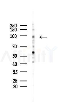 MAP4K5 Mouse Monoclonal Antibody - Western blot analysis of lysates from Hela cells(starvation 24h treatment), using MAP4K5 Mouse Monoclonal Antibody at 1/1000 dilution.