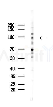 MAP4K5 Mouse Monoclonal Antibody - Western blot analysis of lysates from 293 cells(heat-shock 45min treatment), using MAP4K5 Mouse Monoclonal Antibody at 1/1000 dilution.