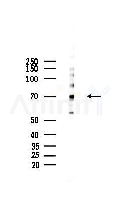 SH2B2 Mouse Monoclonal Antibody - Western blot analysis of lysates from Hela cells(starvation 24h treatment), using SH2B2 Mouse Monoclonal Antibody at 1/1000 dilution.