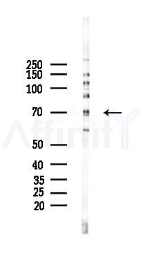 SH2B2 Mouse Monoclonal Antibody - Western blot analysis of lysates from 293 cells(heat-shock 45min treatment), using SH2B2 Mouse Monoclonal Antibody at 1/1000 dilution.