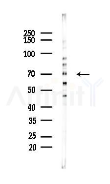 SH2B2 Mouse Monoclonal Antibody - Western blot analysis of lysates from K562 cells(heat-shock 45min treatment), using SH2B2 Mouse Monoclonal Antibody at 1/1000 dilution.