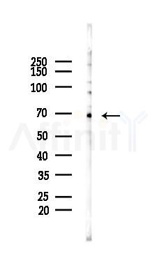 SH2B2 Mouse Monoclonal Antibody - Western blot analysis of lysates from PC12 cells(LPS 4h treatment), using SH2B2 Mouse Monoclonal Antibody at 1/1000 dilution.