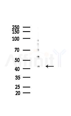 ALDH3B2 Mouse Monoclonal Antibody - Western blot analysis of lysates from COLO205 cells(UV 30min treatment), using ALDH3B2 Mouse Monoclonal Antibody at 1/1000 dilution.