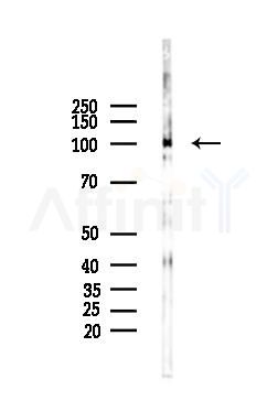 Synphilin-1 Mouse Monoclonal Antibody - Western blot analysis of lysates from Mouse brain, using Synphilin-1 Mouse Monoclonal Antibody at 1/1000 dilution.