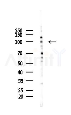 Synphilin-1 Mouse Monoclonal Antibody - Western blot analysis of lysates from Hela cells(starvation 24h treatment), using Synphilin-1 Mouse Monoclonal Antibody at 1/1000 dilution.