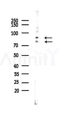 CEP63 Mouse Monoclonal Antibody - Western blot analysis of lysates from K562 cells(heat-shock 45min treatment), using CEP63 Mouse Monoclonal Antibody at 1/1000 dilution.