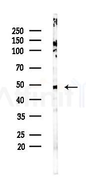 EDAR Mouse Monoclonal Antibody - Western blot analysis of lysates from Rat testis, using EDAR Mouse Monoclonal Antibody at 1/1000 dilution.