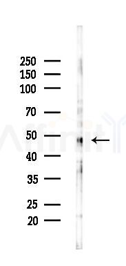 EDAR Mouse Monoclonal Antibody - Western blot analysis of lysates from A2780 cells(LPS 4h treatment), using EDAR Mouse Monoclonal Antibody at 1/1000 dilution.