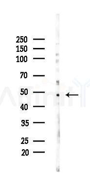EDAR Mouse Monoclonal Antibody - Western blot analysis of lysates from 293 cells(heat-shock 45min treatment), using EDAR Mouse Monoclonal Antibody at 1/1000 dilution.
