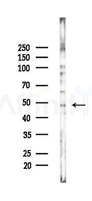 EDAR Mouse Monoclonal Antibody - Western blot analysis of lysates from K562 cells(heat-shock 45min treatment), using EDAR Mouse Monoclonal Antibody at 1/1000 dilution.
