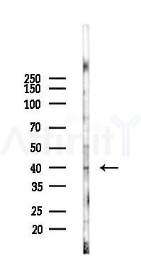 SP6 Mouse Monoclonal Antibody - Western blot analysis of lysates from A2780 cells(LPS 4h treatment), using SP6 Mouse Monoclonal Antibody at 1/1000 dilution.