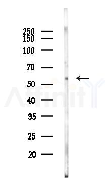ANGPTL1 Mouse Monoclonal Antibody - Western blot analysis of lysates from Rat spleen, using ANGPTL1 Mouse Monoclonal Antibody at 1/1000 dilution.