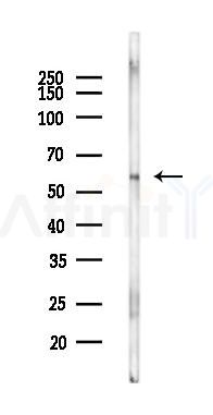 ANGPTL1 Mouse Monoclonal Antibody - Western blot analysis of lysates from Rat muscle, using ANGPTL1 Mouse Monoclonal Antibody at 1/1000 dilution.