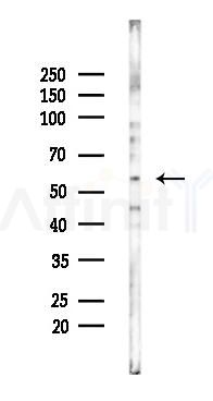 ANGPTL1 Mouse Monoclonal Antibody - Western blot analysis of lysates from COLO205 cells(UV 30min treatment), using ANGPTL1 Mouse Monoclonal Antibody at 1/1000 dilution.