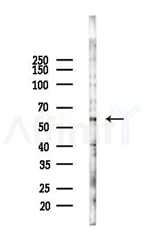 ANGPTL1 Mouse Monoclonal Antibody - Western blot analysis of lysates from HUVEC cells(starvation 24h treatment), using ANGPTL1 Mouse Monoclonal Antibody at 1/1000 dilution.