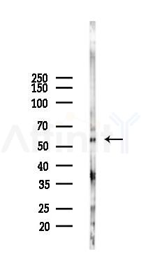 GAS8 Mouse Monoclonal Antibody - Western blot analysis of lysates from Mouse lung, using GAS8 Mouse Monoclonal Antibody at 1/1000 dilution.