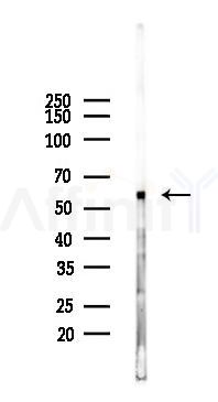 GAS8 Mouse Monoclonal Antibody - Western blot analysis of lysates from Rat lung, using GAS8 Mouse Monoclonal Antibody at 1/1000 dilution.