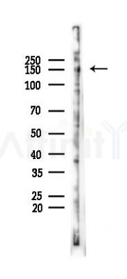 NUP155 Mouse Monoclonal Antibody - Western blot analysis of lysates from HUVEC cells(starvation 24h treatment), using NUP155 Mouse Monoclonal Antibody at 1/1000 dilution.