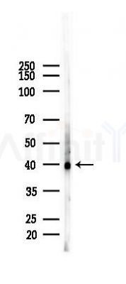 Phospho-p38 MAPK (Tyr182) Mouse Monoclonal Antibody - Western blot analysis of lysates from A2780 cells(LPS 4h treatment), using Phospho-p38 MAPK (Tyr182) Mouse Monoclonal Antibody at 1/1000 dilution.