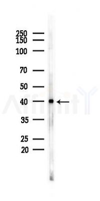 Phospho-p38 MAPK (Tyr182) Mouse Monoclonal Antibody - Western blot analysis of lysates from 293 cells(heat-shock 45min treatment), using Phospho-p38 MAPK (Tyr182) Mouse Monoclonal Antibody at 1/1000 dilution.