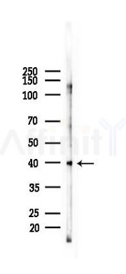 Phospho-p38 MAPK (Tyr182) Mouse Monoclonal Antibody - Western blot analysis of lysates from HepG2 cells(UV 30min treatment), using Phospho-p38 MAPK (Tyr182) Mouse Monoclonal Antibody at 1/1000 dilution.