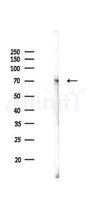 Phospho-ZAP70 (Tyr493) Mouse Monoclonal Antibody - Western blot analysis of lysates from Rat muscle, using Phospho-ZAP70 (Tyr493) Mouse Monoclonal Antibody at 1/1000 dilution.