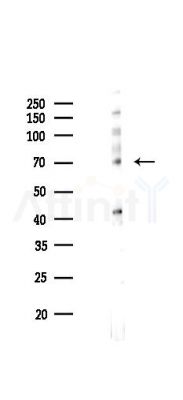 Phospho-ZAP70 (Tyr493) Mouse Monoclonal Antibody - Western blot analysis of lysates from Hela cells(starvation 24h treatment), using Phospho-ZAP70 (Tyr493) Mouse Monoclonal Antibody at 1/1000 dilution.