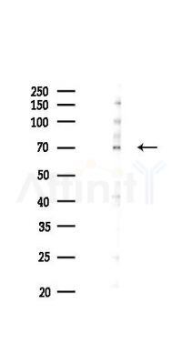Phospho-ZAP70 (Tyr493) Mouse Monoclonal Antibody - Western blot analysis of lysates from HUVEC cells(starvation 24h treatment), using Phospho-ZAP70 (Tyr493) Mouse Monoclonal Antibody at 1/1000 dilution.