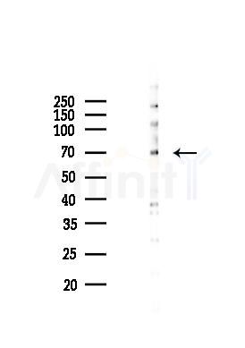 Phospho-ZAP70 (Tyr493) Mouse Monoclonal Antibody - Western blot analysis of lysates from HepG2 cells(UV 30min treatment), using Phospho-ZAP70 (Tyr493) Mouse Monoclonal Antibody at 1/1000 dilution.