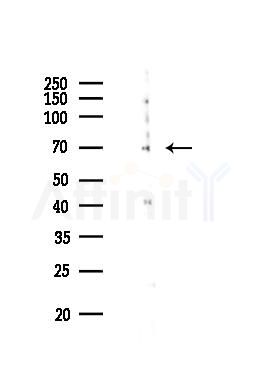 Phospho-ZAP70 (Tyr493) Mouse Monoclonal Antibody - Western blot analysis of lysates from COLO205 cells(UV 30min treatment), using Phospho-ZAP70 (Tyr493) Mouse Monoclonal Antibody at 1/1000 dilution.