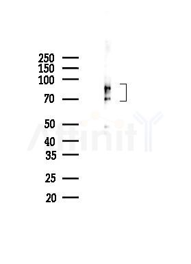 Phospho-Tau (Ser356)[Ser673] Mouse Monoclonal Antibody - Western blot analysis of lysates from Mouse brain, using Phospho-Tau (Ser356)[Ser673] Mouse Monoclonal Antibody at 1/1000 dilution.