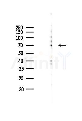Phospho-Tau (Ser356)[Ser673] Mouse Monoclonal Antibody - Western blot analysis of lysates from 293 cells(heat-shock 45min treatment), using Phospho-Tau (Ser356)[Ser673] Mouse Monoclonal Antibody at 1/1000 dilution.