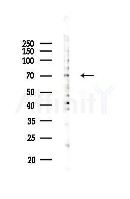 Phospho-Tau (Ser356)[Ser673] Mouse Monoclonal Antibody - Western blot analysis of lysates from COLO205 cells(UV 30min treatment), using Phospho-Tau (Ser356)[Ser673] Mouse Monoclonal Antibody at 1/1000 dilution.