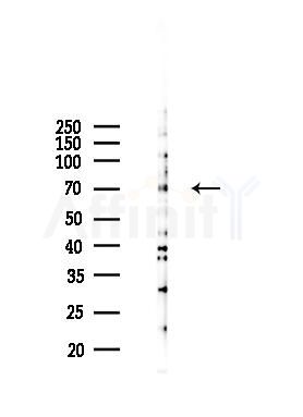 Phospho-Tau (Ser356)[Ser673] Mouse Monoclonal Antibody - Western blot analysis of lysates from HepG2 cells(UV 30min treatment), using Phospho-Tau (Ser356)[Ser673] Mouse Monoclonal Antibody at 1/1000 dilution.