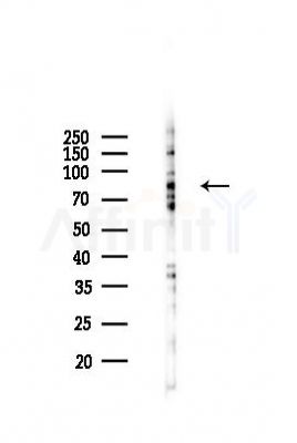 Phospho-TrkA (Tyr680+Tyr681) Mouse Monoclonal Antibody - Western blot analysis of lysates from HepG2 cells(UV 30min treatment), using Phospho-TrkA (Tyr680+Tyr681) Mouse Monoclonal Antibody at 1/1000 dilution.
