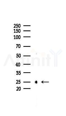 Phospho-HSP27 (Ser82) Mouse Monoclonal Antibody - Western blot analysis of lysates from K562 cells(heat-shock 45min treatment), using Phospho-HSP27 (Ser82) Mouse Monoclonal Antibody at 1/1000 dilution.
