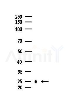 Phospho-HSP27 (Ser82) Mouse Monoclonal Antibody - Western blot analysis of lysates from COLO205 cells(UV 30min treatment), using Phospho-HSP27 (Ser82) Mouse Monoclonal Antibody at 1/1000 dilution.