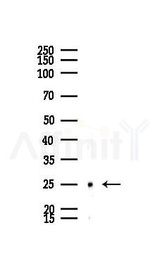 Phospho-HSP27 (Ser82) Mouse Monoclonal Antibody - Western blot analysis of lysates from Mouse lung, using Phospho-HSP27 (Ser82) Mouse Monoclonal Antibody at 1/1000 dilution.