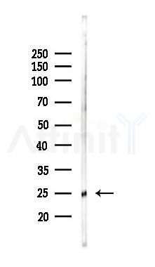 Phospho-HSP27 (Ser82) Mouse Monoclonal Antibody - Western blot analysis of lysates from HUVEC cells(LPS 4h treatment), using Phospho-HSP27 (Ser82) Mouse Monoclonal Antibody at 1/1000 dilution.