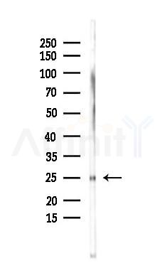 Phospho-HSP27 (Ser82) Mouse Monoclonal Antibody - Western blot analysis of lysates from Mouse testis, using Phospho-HSP27 (Ser82) Mouse Monoclonal Antibody at 1/1000 dilution.
