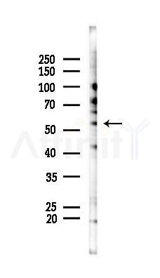 Phospho-RIP3/RIPK3 (Ser227) Mouse Monoclonal Antibody - Western blot analysis of lysates from HUVEC cells(LPS 4h treatment), using Phospho-RIP3/RIPK3 (Ser227) Mouse Monoclonal Antibody at 1/1000 dilution.