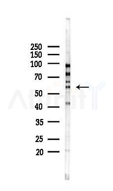 Phospho-RIP3/RIPK3 (Ser227) Mouse Monoclonal Antibody - Western blot analysis of lysates from 293 cells(heat-shock 45min treatment), using Phospho-RIP3/RIPK3 (Ser227) Mouse Monoclonal Antibody at 1/1000 dilution.