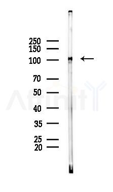 Phospho-NIK (Thr559) Mouse Monoclonal Antibody - Western blot analysis of lysates from RAW264.