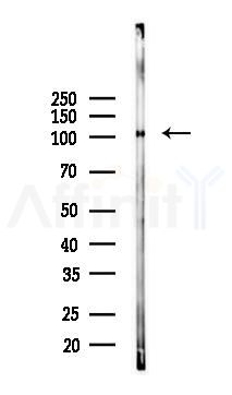 Phospho-NIK (Thr559) Mouse Monoclonal Antibody - Western blot analysis of lysates from B16F10-LUC cells(LPS 4h treatment), using Phospho-NIK (Thr559) Mouse Monoclonal Antibody at 1/1000 dilution.