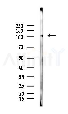 Phospho-NIK (Thr559) Mouse Monoclonal Antibody - Western blot analysis of lysates from PC12 cells(starvation 24h treatment), using Phospho-NIK (Thr559) Mouse Monoclonal Antibody at 1/1000 dilution.