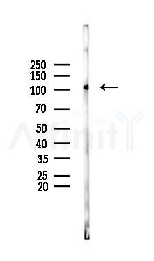 Phospho-NIK (Thr559) Mouse Monoclonal Antibody - Western blot analysis of lysates from A2780 cells(LPS 4h treatment), using Phospho-NIK (Thr559) Mouse Monoclonal Antibody at 1/1000 dilution.